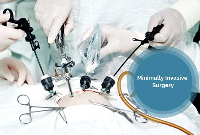 Knee Replacement