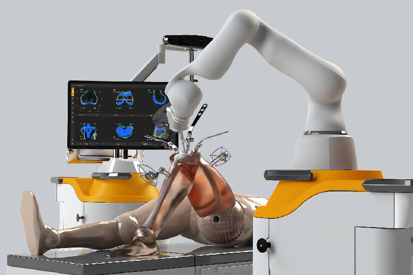 Robotic Joint Replacement
